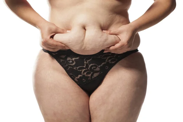 Tłuszcz na brzuchu — Zdjęcie stockowe