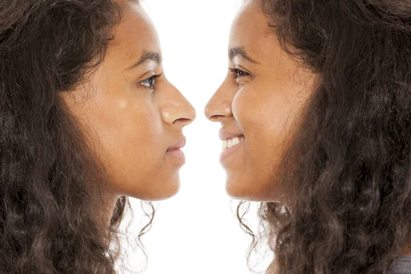 Rhinoplasty before and after — Stock Photo, Image