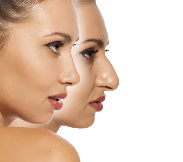 Is Rhinoplasty Dangerous? 10 FAQs and Answers to Know Before Making Decision