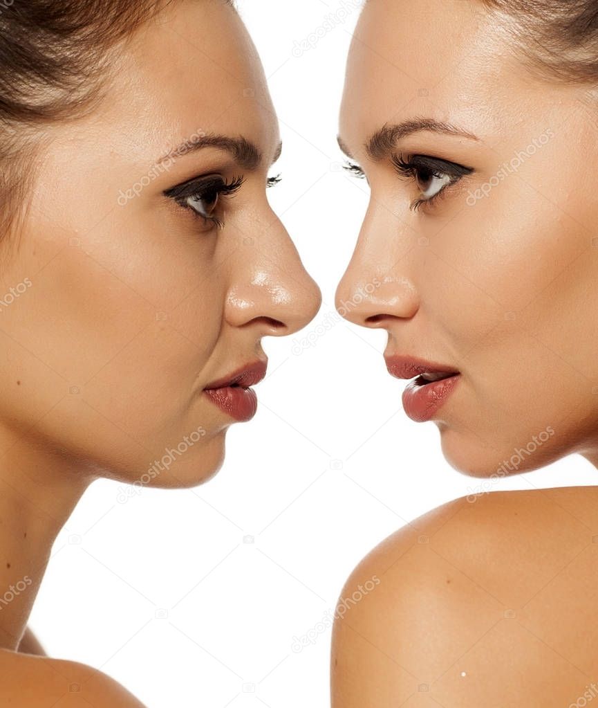 Comparison of a female nose before and after cosmetic surgery