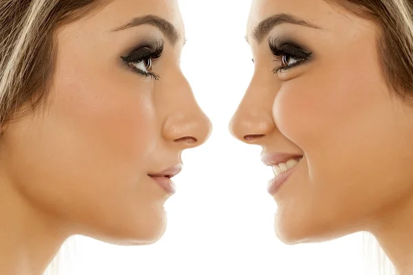 Σύγκριση Της Γυναικείας Μύτη Πριν Και Μετά Την Πλαστική Χειρουργική — Φωτογραφία Αρχείου