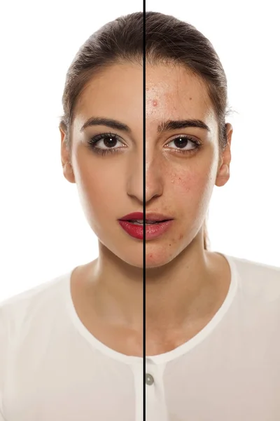 Portrait Comparatif Visage Féminin Peau Problématique Avant Après Maquillage — Photo