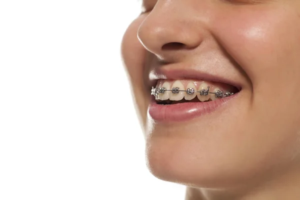 Joven Mujer Sonriente Con Tirantes Sobre Fondo Blanco — Foto de Stock