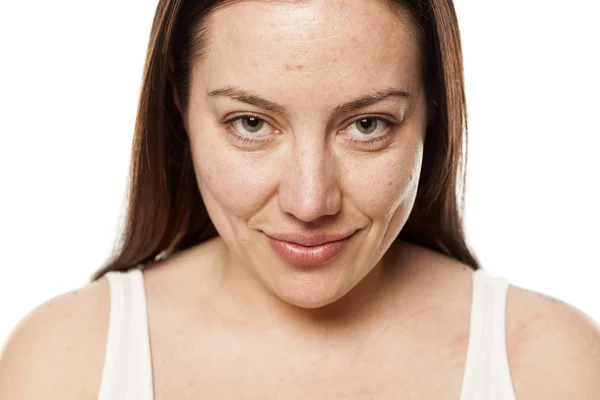 Portrait Une Jeune Femme Souriante Sans Maquillage Sur Fond Blanc — Photo