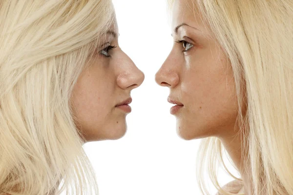 Junge Blonde Frau Reinigt Ihr Gesicht Mit Wattepads Auf Weißem — Stockfoto