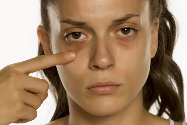 Junge Frau Berührt Ihre Niedrigen Augenlider Auf Gelbem Hintergrund — Stockfoto