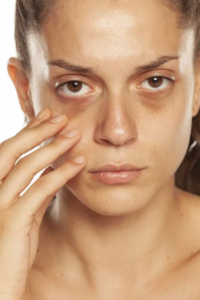 Junge Frau berührt ihre niedrigen Augenlider auf gelbem Hintergrund — Stockfoto