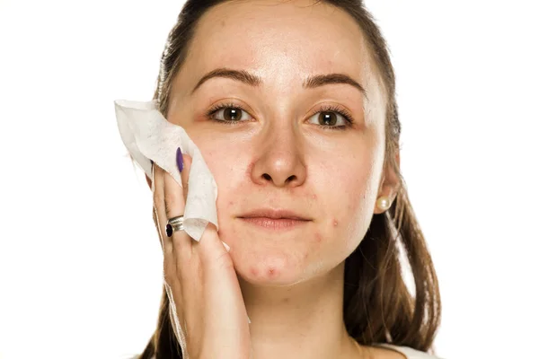 Uma Mulher Limpando Rosto Com Tecido Molhado Fundo Branco — Fotografia de Stock