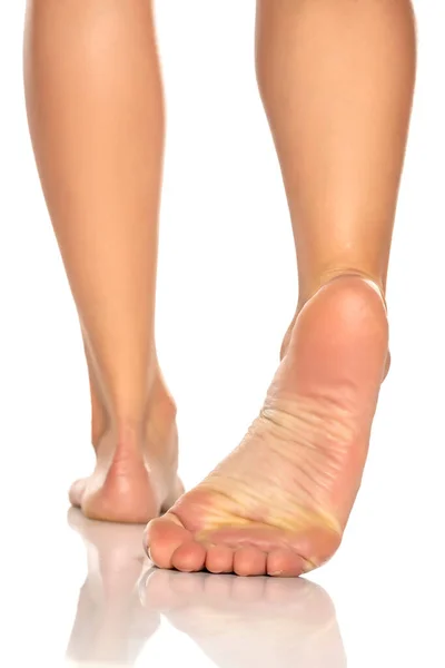 Красиво Ухоженная Женская Нога Белом Фоне — стоковое фото