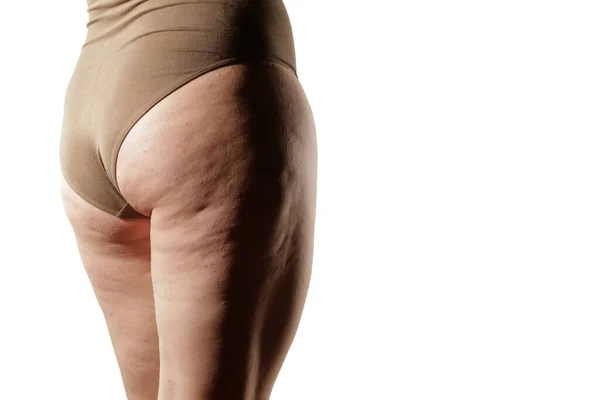 Ноги Сідниці Жінок Ожирінням Целюліт — стокове фото