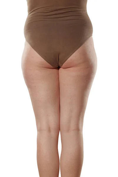 Elhízott Nők Cellulit Lábai — Stock Fotó