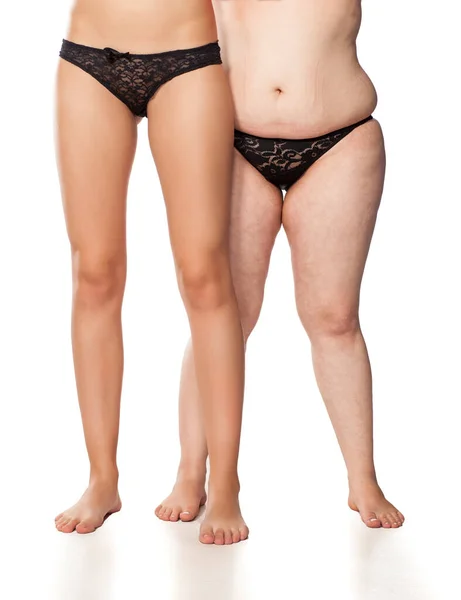 Kobiece Nogi Porównujące Tłuszcz Chudą — Zdjęcie stockowe