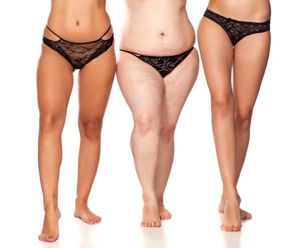 Pernas Uma Mulher Três Mulheres Com Pesos Diferentes — Fotografia de Stock