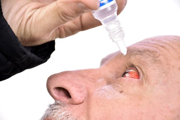 Hombre mayor goteando un ojo rojo con gotas para los ojos —  Fotos de Stock