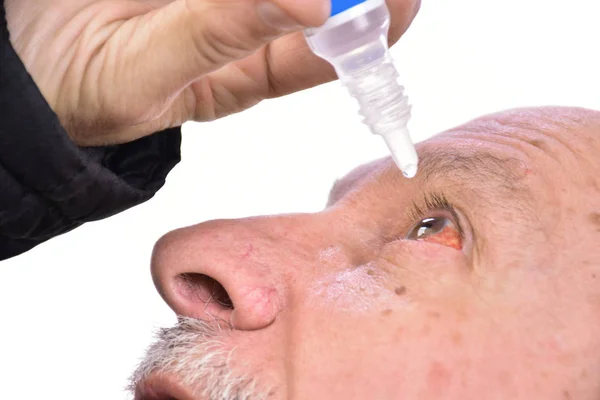 Hombre mayor goteando un ojo rojo con gotas para los ojos —  Fotos de Stock