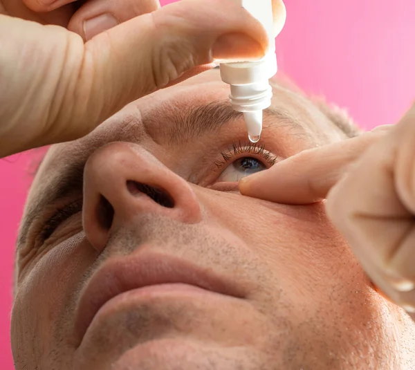 Healthcare Medical Concept Closeup View Young Man Applying Eye Drop — Stock Photo, Image