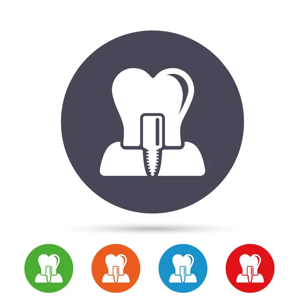 Tooth implant icons set — Stock Vector