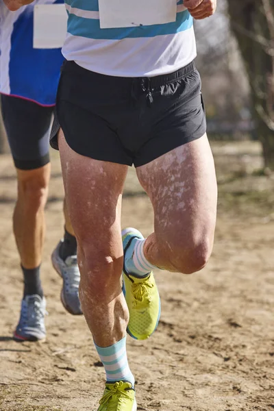 Läufer Mit Vitiligo Krankheit Auf Einem Cross Crountry Rennen Gesunder — Stockfoto