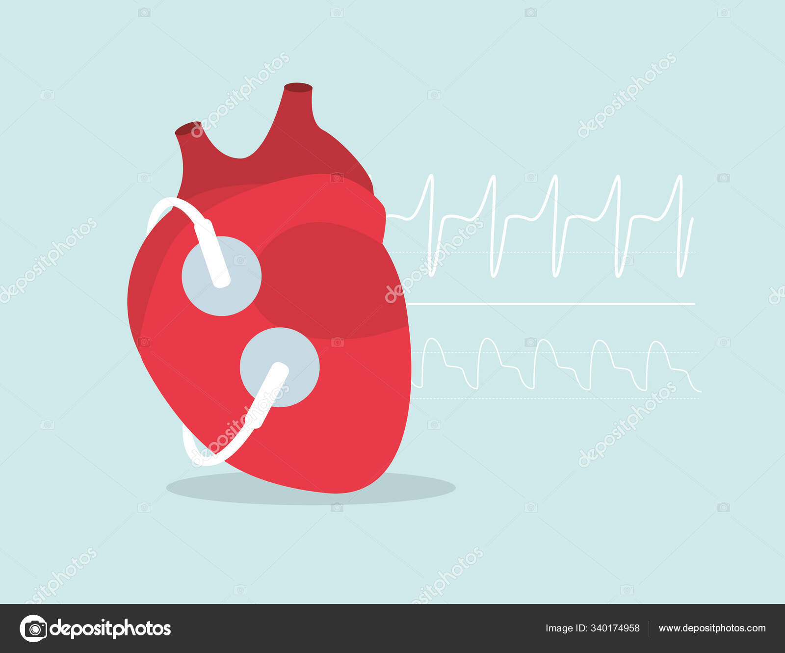 Heart Electrodes Check Heart Beating Ecg Heart Rate Monitor Medical Stock Vector by ©idioma1