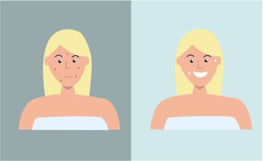 Illustration of Acne Therapy. Woman with acne and clear face. Before and after effect. Cosmetology. Flat vector illustration