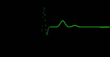 Loopable: Ekg satır / Ekg monitör / Ekg makinesi / kalp sağlığı
