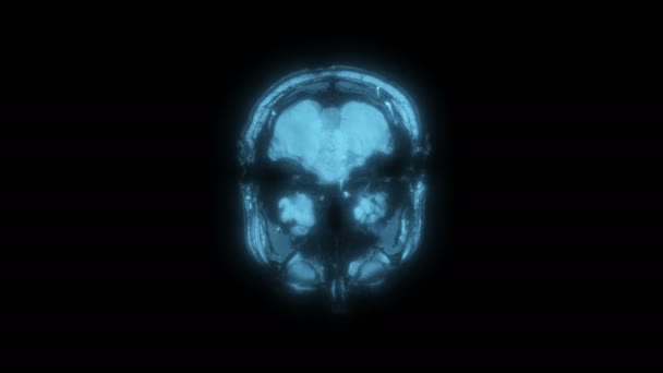 Resonancia magnética Imágenes por resonancia magnética de un cerebro humano, ultra hd 4k, lapso de tiempo. Radiografía, tomografía médica computarizada. Médico color azul — Vídeos de Stock
