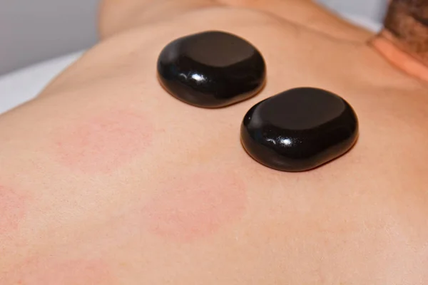 Wellnessconcept. Knappe jongeman ontspannen onder het stimulerende effect van een traditionele hot stone massage in een luxe spa en wellness centrum. Herstel na het werk. — Stockfoto