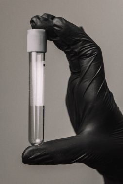 Empty test tube in a glass flask in the hands of a scientist or cosmetologist. Black gloves on a gray background. Experiment, analyzes, girl from the back.