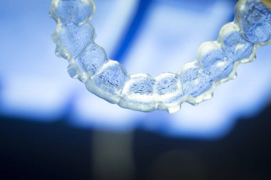 Görünmez diş aligners