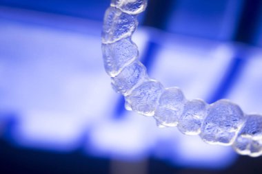 Görünmez diş aligners