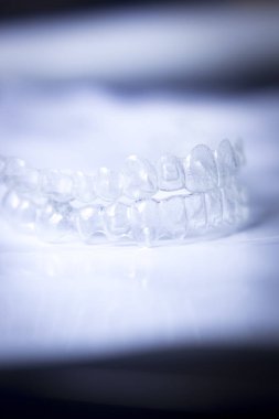 Görünmez diş aligners