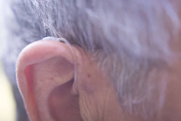 現代のデジタル補聴器 — ストック写真