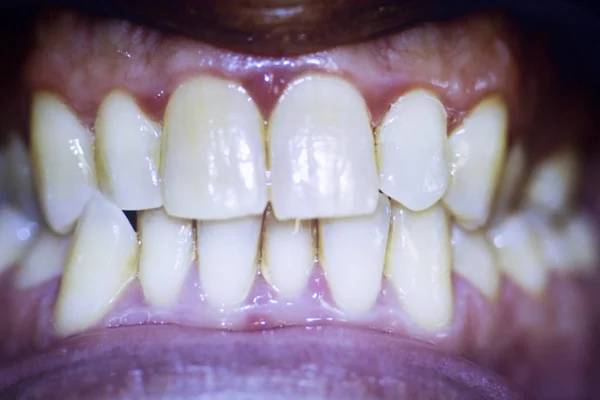 Diş hekimleri diş diş fotoğraf — Stok fotoğraf