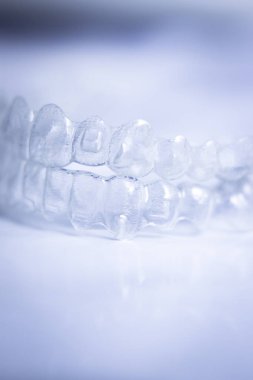 Görünmez diş aligners