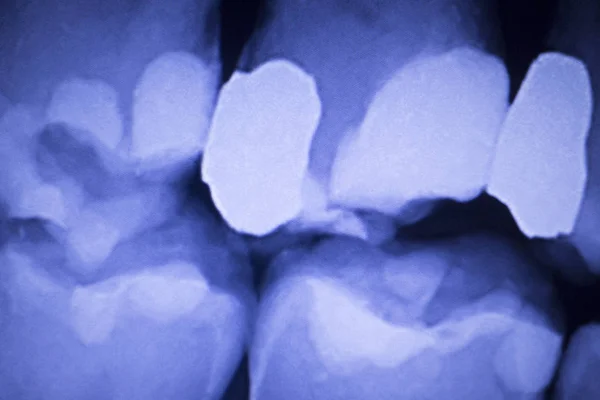 Tandläkare tandvård tänder xray — Stockfoto