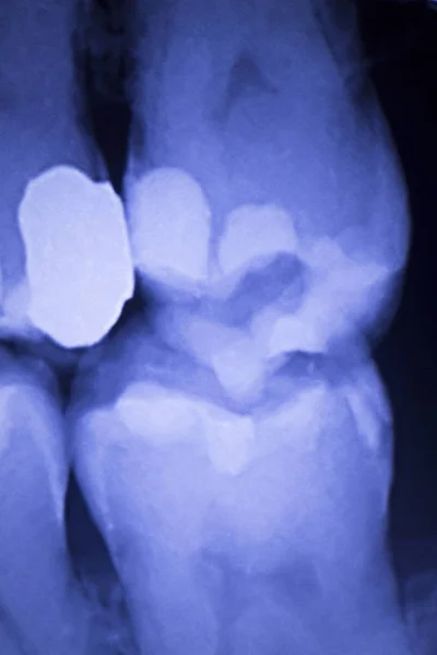Zahnärzte Zähne Röntgen — Stockfoto