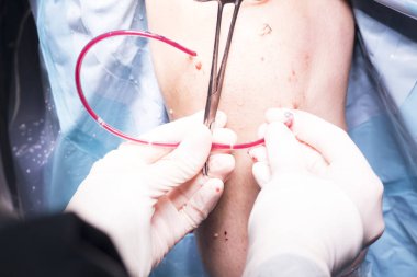 Cerrahi operasyon diz cerrahisi