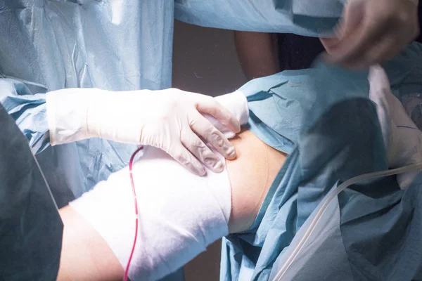 Bandaging post knee surgery — Stock Photo, Image