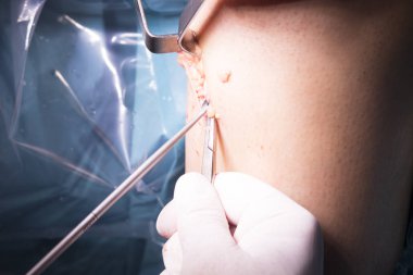 Cerrahi operasyon diz cerrahisi