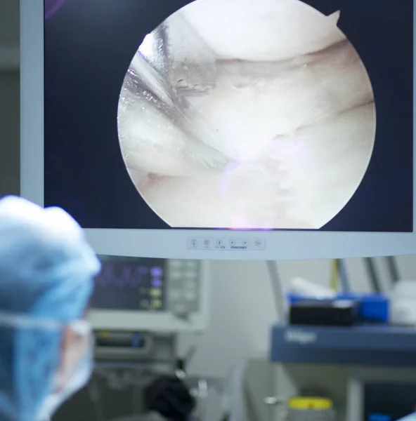 Tela de cirurgia de artroscopia — Fotografia de Stock