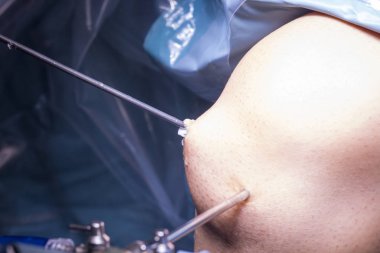 Cerrahi operasyon diz cerrahisi