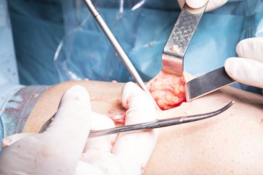 Cerrahi operasyon diz cerrahisi