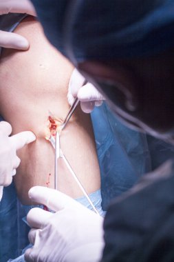 Cerrahi operasyon diz cerrahisi