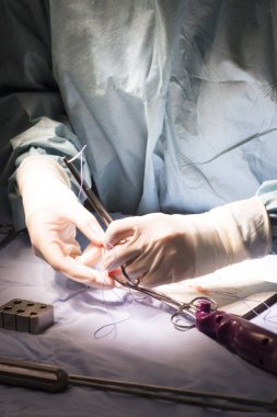 Diz tendon bağ ameliyatı