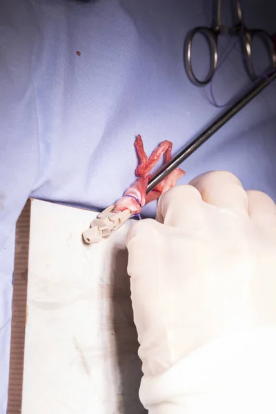 Diz tendon bağ ameliyatı — Stok fotoğraf
