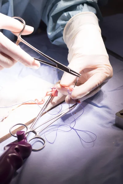 Хірургічне втручання сухожилля коліна — стокове фото
