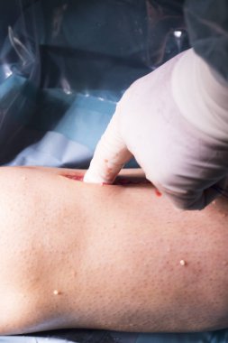 Cerrahi operasyon diz cerrahisi