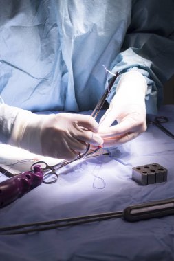 Diz tendon bağ ameliyatı