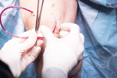 Cerrahi operasyon diz cerrahisi