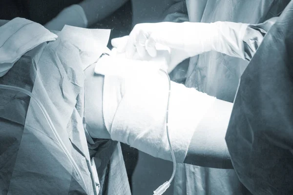 Bandage efter knäoperation — Stockfoto